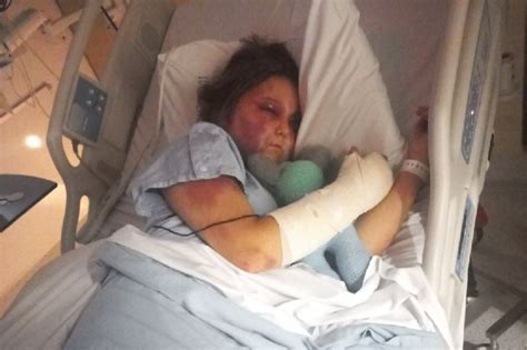 Kirra Hart’s story — Her brutal attack explained